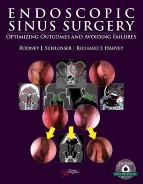 Endoscopic Sinus Surgery : Optimizing Outcomes and Avoiding Failures, Hardback Book