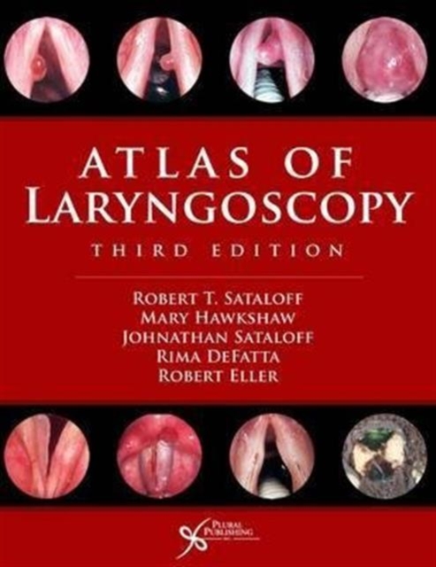 Atlas of Laryngoscopy, Hardback Book