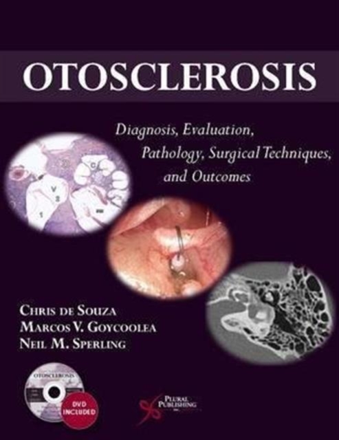 Otosclerosis : Diagnosis, Evaluation, Pathology, Surgical Techniques, and Outcomes, Multiple-component retail product Book