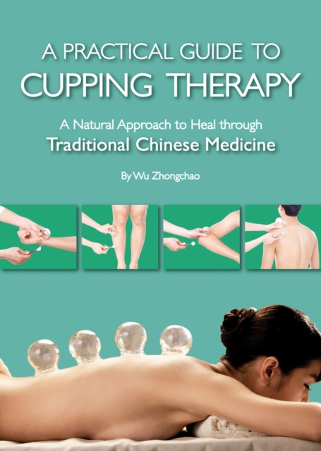 A Practical Guide to Cupping Therapy : A Natural Approach to Heal Through Traditional Chinese Medicine, Hardback Book