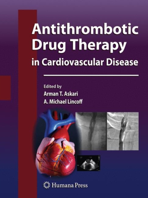 Antithrombotic Drug Therapy in Cardiovascular Disease, Hardback Book