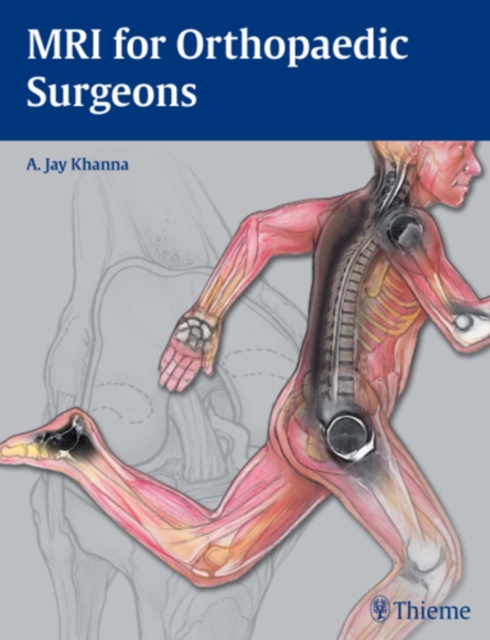 MRI for Orthopaedic Surgeons, Hardback Book