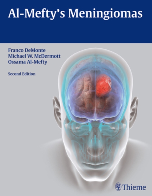 Al-Mefty's Meningiomas, Hardback Book