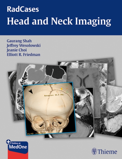RadCases Head and Neck Imaging, Paperback / softback Book