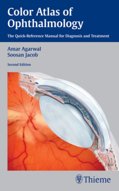 Color Atlas of Ophthalmology : The Quick-Reference Manual for Diagnosis and Treatment, Paperback / softback Book