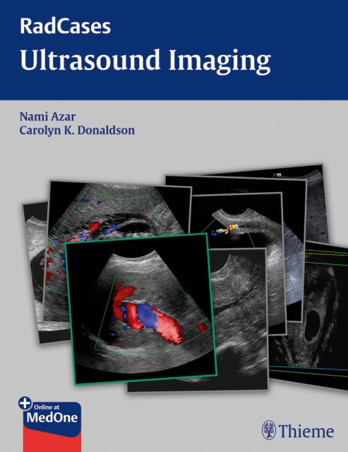 Radcases Ultrasound Imaging, Paperback / softback Book