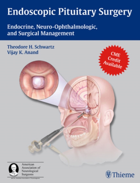 Endoscopic Pituitary Surgery : Endocrine, Neuro-Ophthalmologic, and Surgical Management, Hardback Book