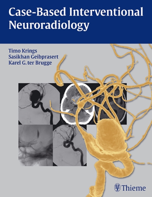 Case-Based Interventional Neuroradiology, Paperback / softback Book