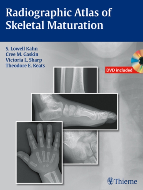 Radiographic Atlas of Skeletal Maturation, Hardback Book