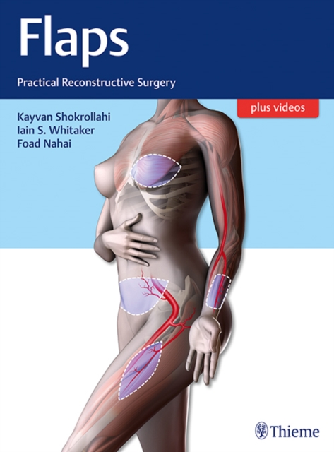 Flaps : Practical Reconstructive Surgery, Mixed media product Book