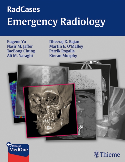 Radcases Emergency Radiology, Paperback / softback Book