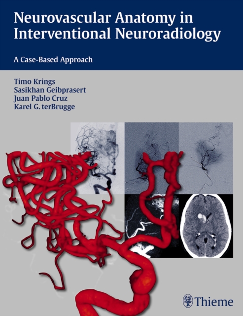 Neurovascular Anatomy in Interventional Neuroradiology : A Case-Based Approach, Paperback / softback Book