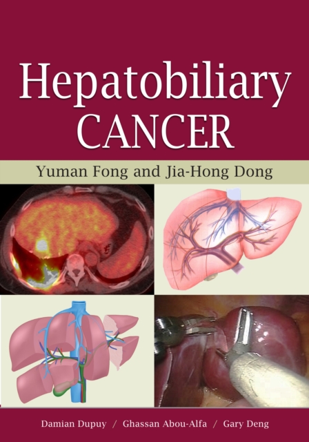 Hepatobiliary Cancer, EPUB eBook