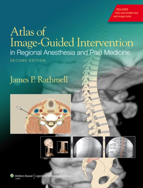 Atlas of Image-Guided Intervention in Regional Anesthesia and Pain Medicine, Hardback Book