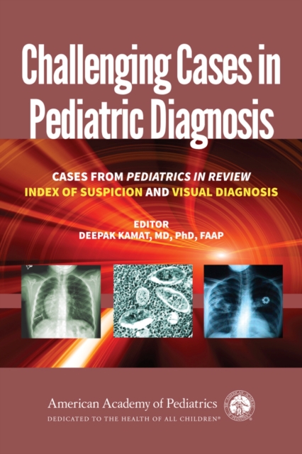Challenging Cases in Pediatric Diagnosis : Cases from Pediatrics in Review, Index of Suspicion and Visual Diagnosis, Paperback / softback Book