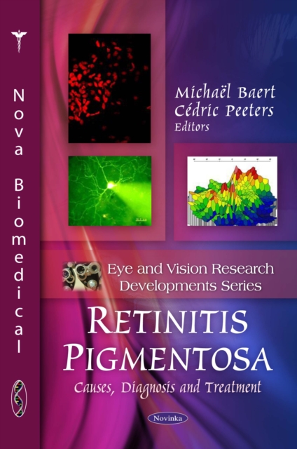 Retinitis Pigmentosa : Causes, Diagnosis and Treatment, PDF eBook