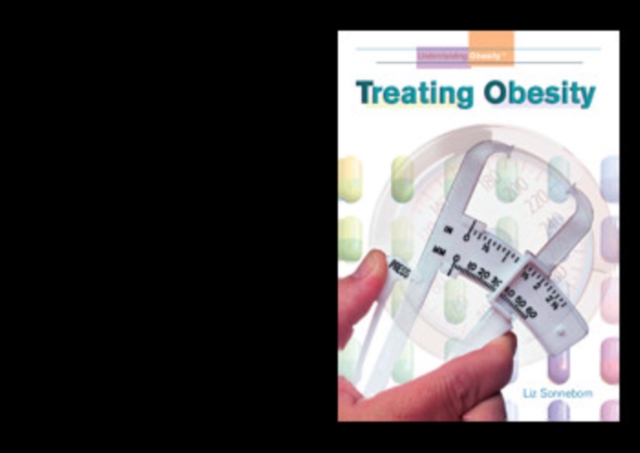 Treating Obesity, PDF eBook