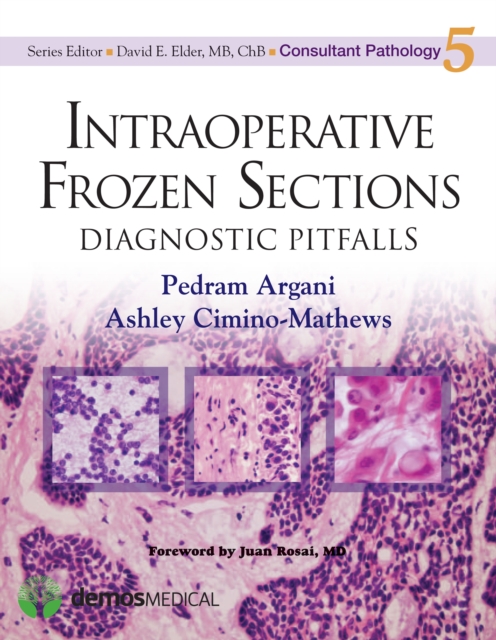 Intraoperative Frozen Sections : Diagnostic Pitfalls, EPUB eBook
