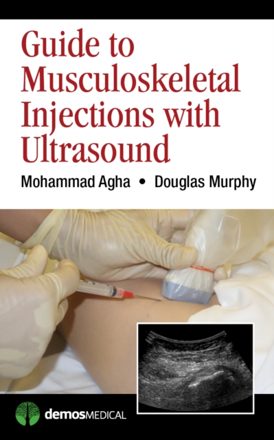 Guide to Musculoskeletal Injections with Ultrasound, EPUB eBook