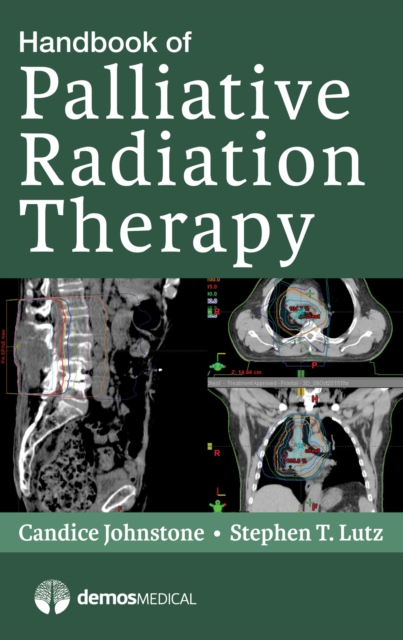 Handbook of Palliative Radiation Therapy, EPUB eBook