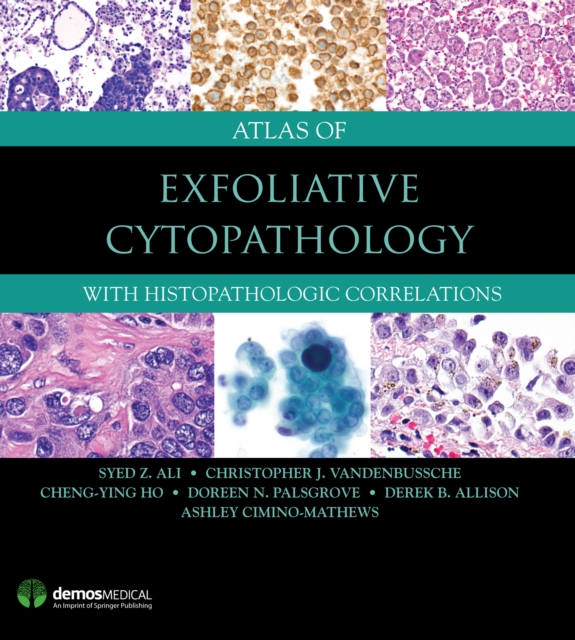 Atlas of Exfoliative Cytopathology : With Histopathologic Correlations, EPUB eBook