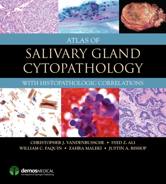 Atlas of Salivary Gland Cytopathology : with Histopathologic Correlations, EPUB eBook