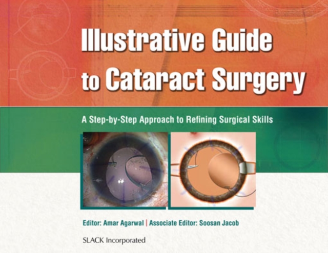 Illustrative Guide to Cataract Surgery : A Step-by-Step Approach to Refining Surgical Skills, EPUB eBook