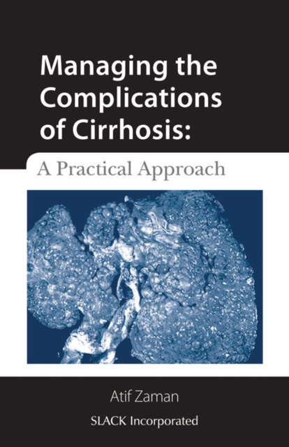Managing the Complications of Cirrhosis : A Practical Approach, PDF eBook