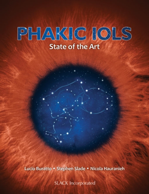 Phakic IOLs : State of the Art, PDF eBook
