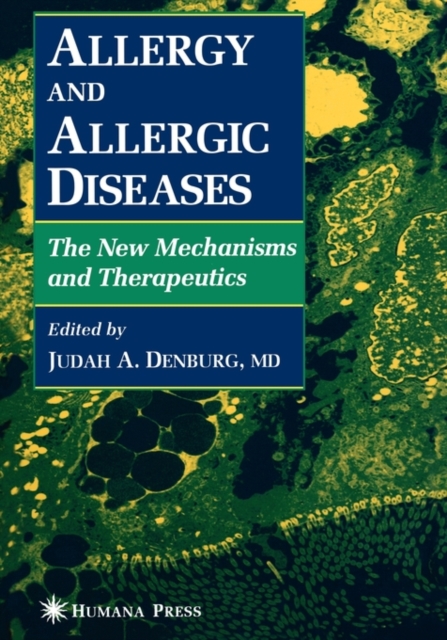 Allergy and Allergic Diseases : The New Mechanisms and Therapeutics, Paperback / softback Book