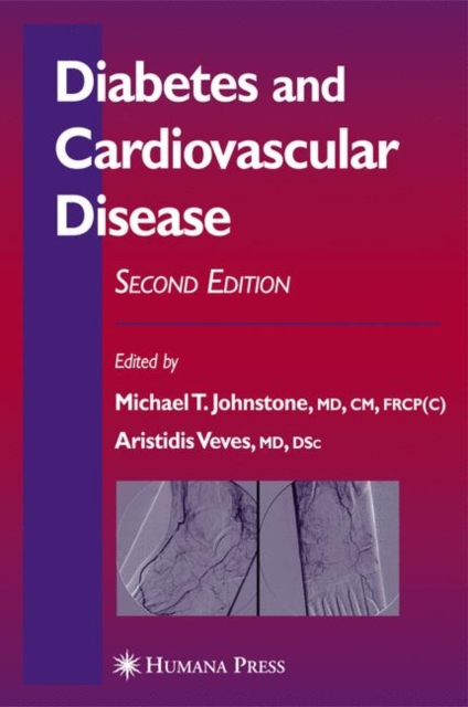 Diabetes and Cardiovascular Disease, Paperback / softback Book
