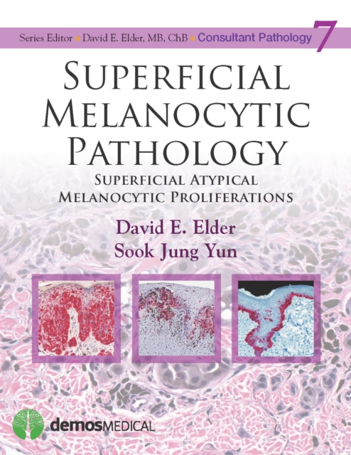 Superficial Melanocytic Pathology, Hardback Book