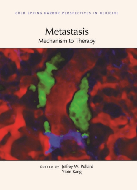 Metastasis: Mechanism to Therapy, Hardback Book