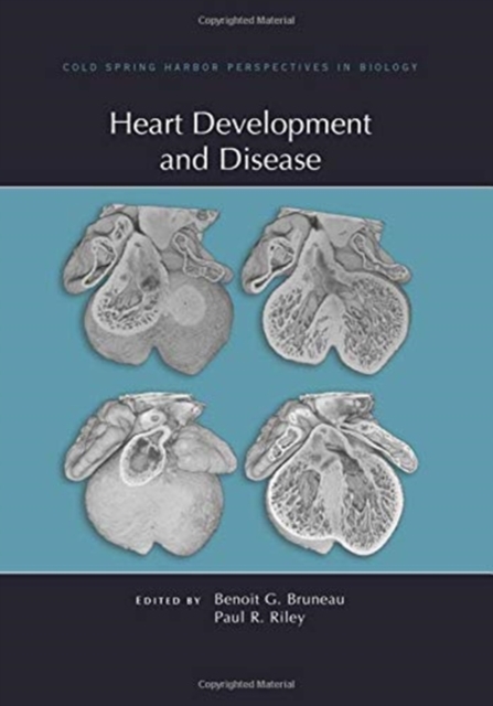 Heart Development and Disease, Hardback Book