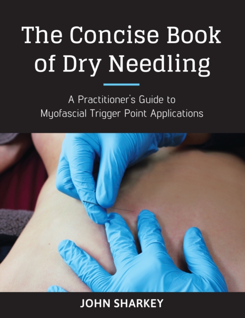 Concise Book of Dry Needling, EPUB eBook