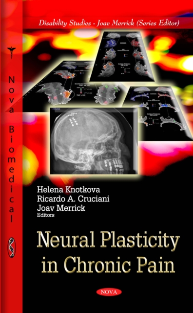 Neural Plasticity in Chronic Pain, PDF eBook