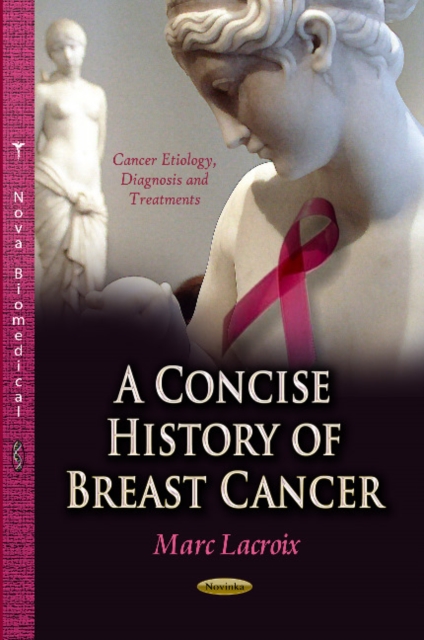 Concise History of Breast Cancer, Paperback / softback Book