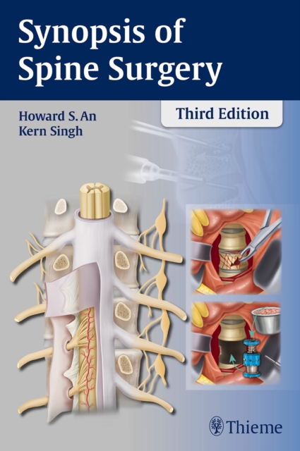 Synopsis of Spine Surgery, Paperback / softback Book