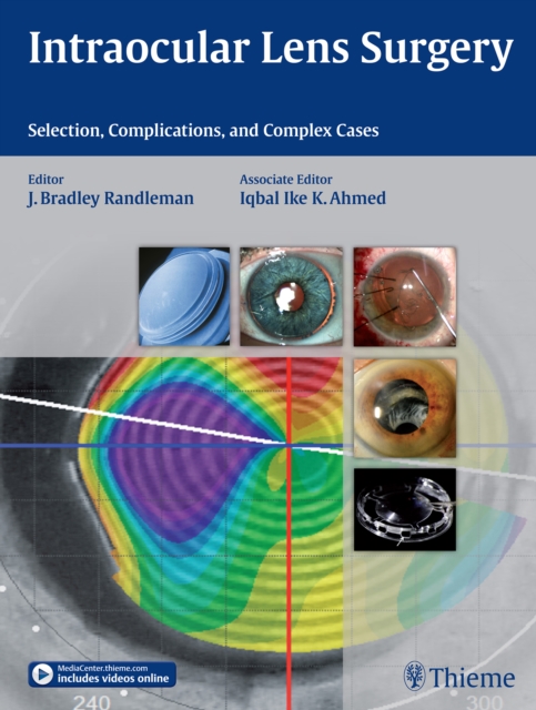 Intraocular Lens Surgery : Selection, Complications, and Complex Cases, Hardback Book