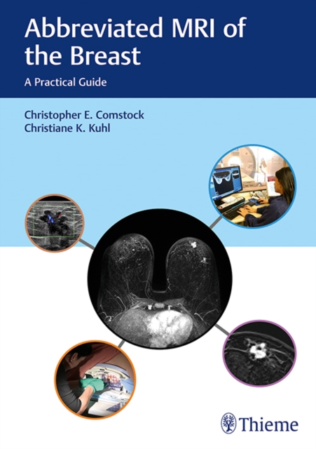 Abbreviated MRI of the Breast : A Practical Guide, Hardback Book