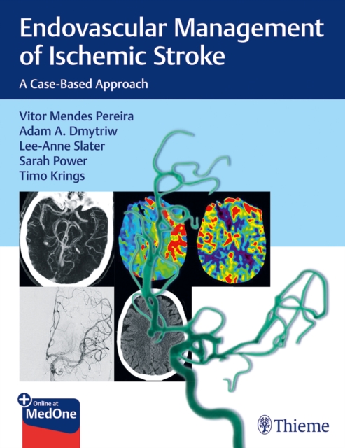 Endovascular Management of Ischemic Stroke : A Case-Based Approach, Mixed media product Book