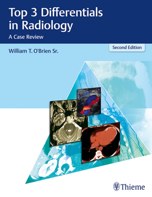 Top 3 Differentials in Radiology : A Case Review, Hardback Book
