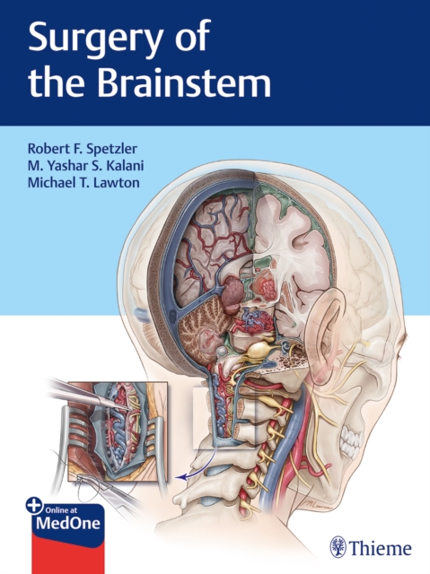 Surgery of the Brainstem, Multiple-component retail product, part(s) enclose Book