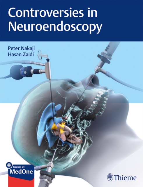 Controversies in Neuroendoscopy, Mixed media product Book