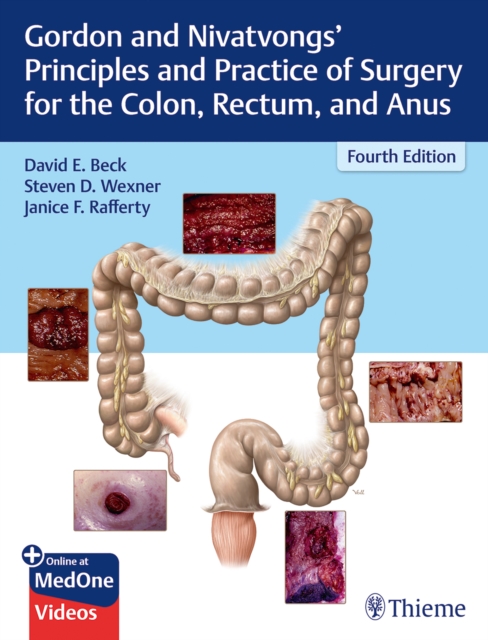 Gordon and Nivatvongs' Principles and Practice of Surgery for the Colon, Rectum, and Anus, Multiple-component retail product, part(s) enclose Book