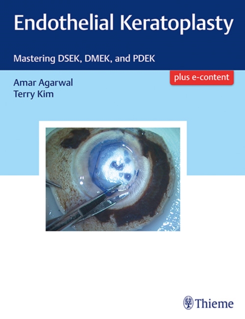 Endothelial Keratoplasty : Mastering DSEK, DMEK, and PDEK, Hardback Book