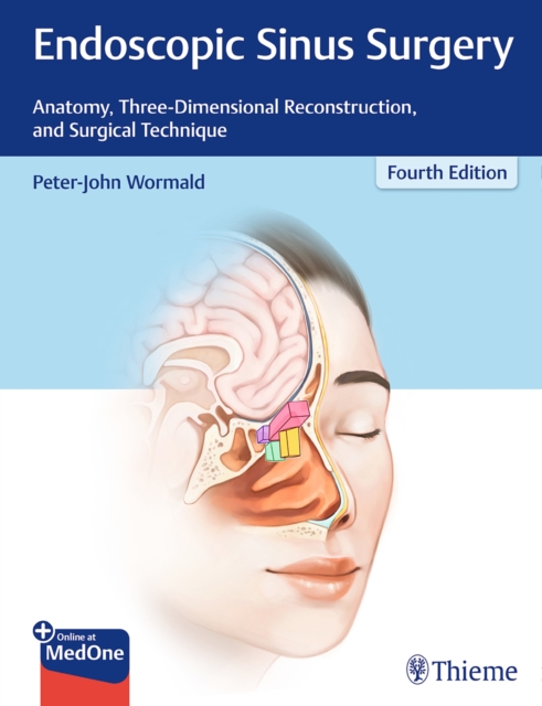 Endoscopic Sinus Surgery : Anatomy, Three-Dimensional Reconstruction, and Surgical Technique, Hardback Book