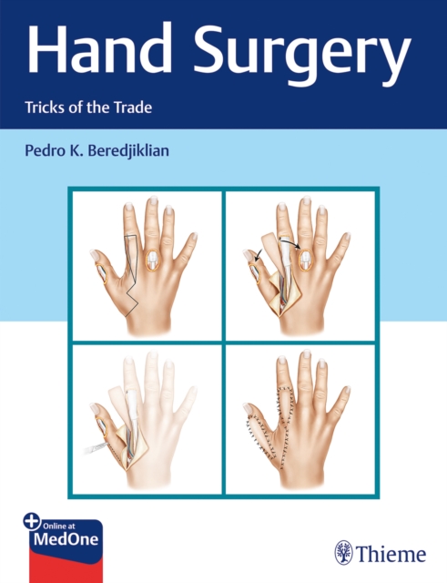 Hand Surgery : Tricks of the Trade, Mixed media product Book