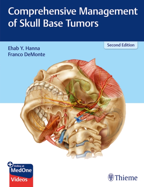 Comprehensive Management of Skull Base Tumors, Multiple-component retail product, part(s) enclose Book