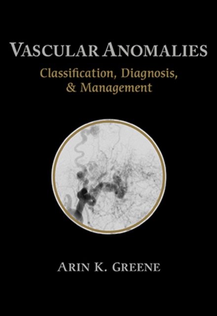 Vascular Anomalies : Classification, Diagnosis, and Management, Paperback / softback Book